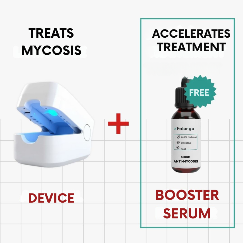 Appareil anti-mycoses - Ongles sains et protégés